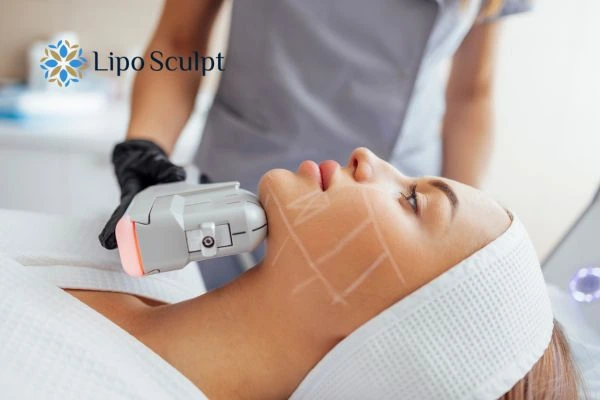 HIFU vs Botulinum Toxin: Understanding the Differences 1 HIFU vs Botox Altrincham What is the best option for you?