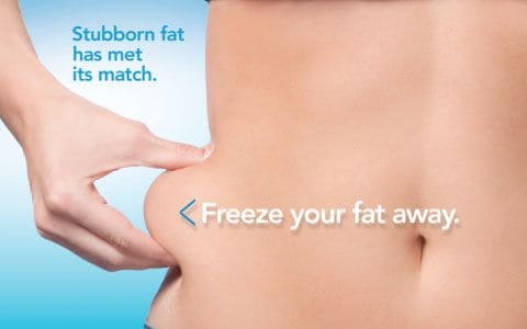 Hips treatment Altrincham From Lipo Sculpt