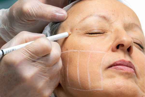 CryoPen: 5 Skin Concerns It May Be Used to Treat 4 What should you ask before having CryoPen treatment Altrincham?