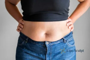 Bidding Farewell to Muffin Tops with Aqualyx Fat Injections 2 Do you wish you could reduce your muffin top Altrincham With Aqualy fat dissolving injections you can!